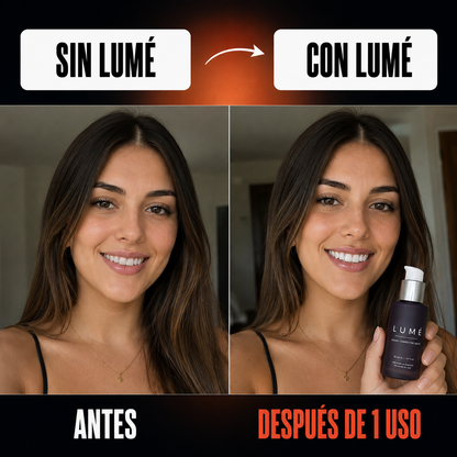 Lumé - Matizador dental, Volve blanca tu sonrisa